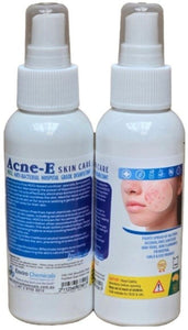 Hydro E Acne-E (HOCL Base) 100ml Spray Bottle